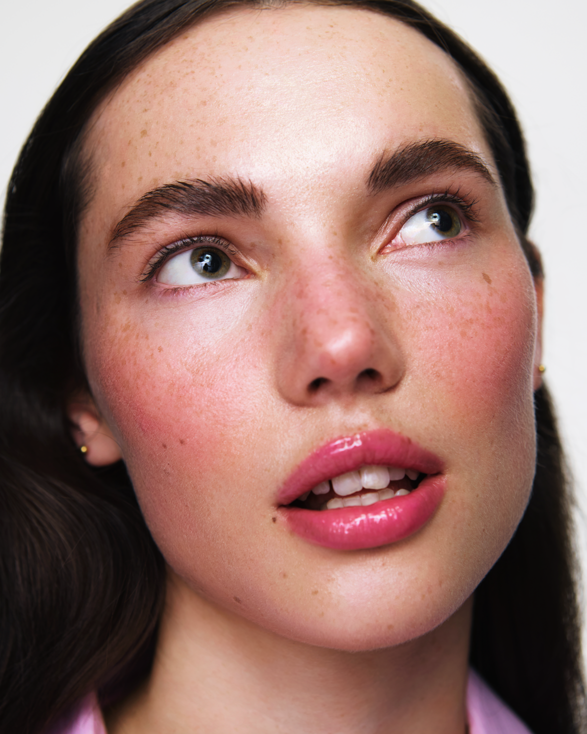Stop blaming your skin: Why over-treating your acne is making it worse ?